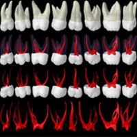 Molar-Root-Canal-Anatomy-3_r1_c12-200x200